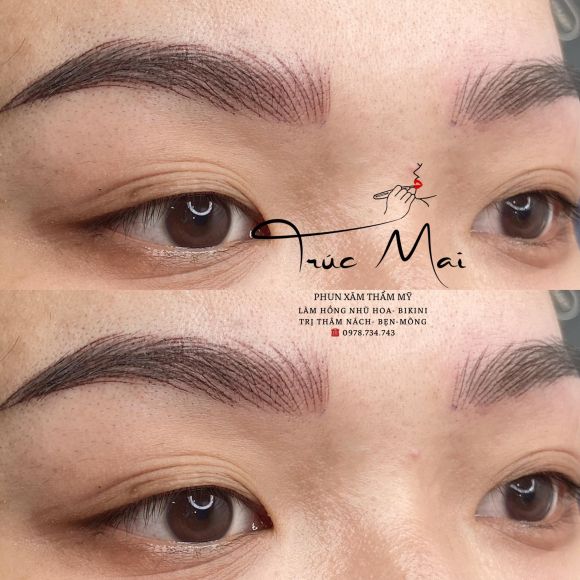 Thẩm mỹ viện - Phun xăm