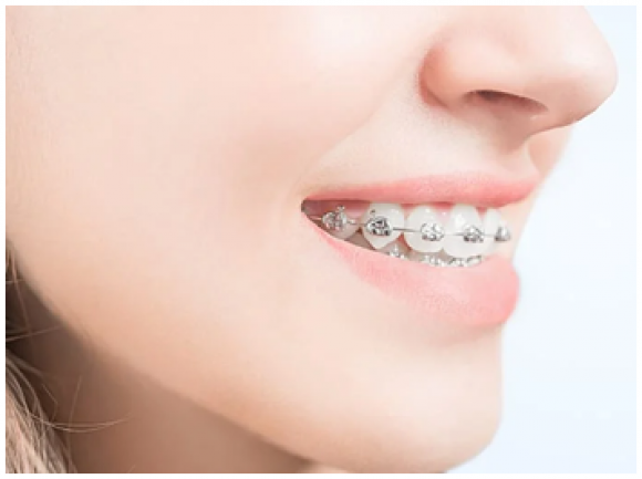 Top 3 Phòng Khám Nha Khoa Uy Tín Tại Bình Tân Dịch Vụ Tốt Nhất