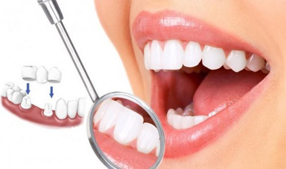 Top 3 Phòng Khám Nha Khoa Uy Tín Tại Bình Tân Dịch Vụ Tốt Nhất
