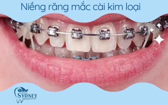 Top 3 Phòng Khám Nha Khoa Uy Tín Tại Bình Tân Dịch Vụ Tốt Nhất