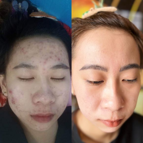 Thẩm mỹ viện - Phun xăm