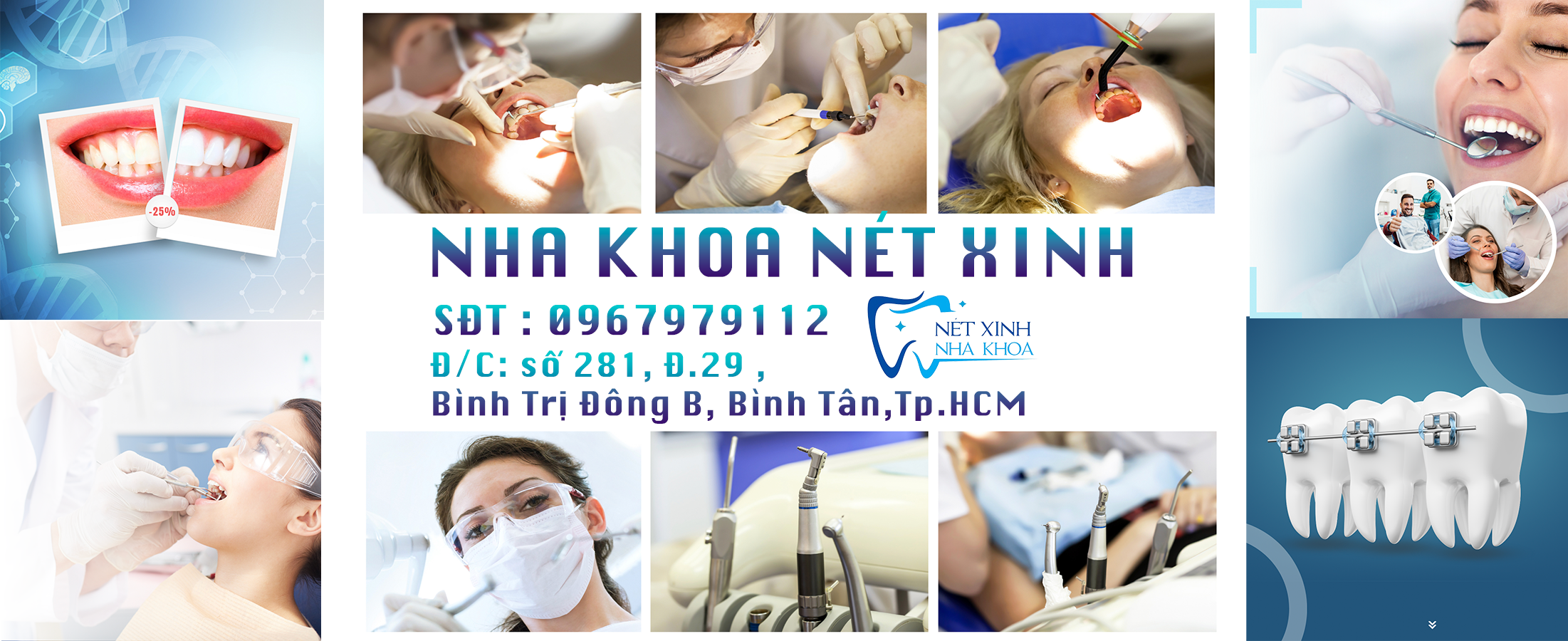 Địa chỉ cạo vôi răng tốt nhất Bình Tân