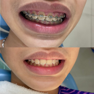 Top 3 địa chỉ làm răng tốt nhất Bình Tân
