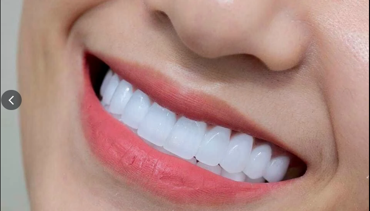 Top 3 Labo Giá Hợp Lý, Nhiệt Tình, Chuyên Nghiệp Tại Quận Gò Vấp