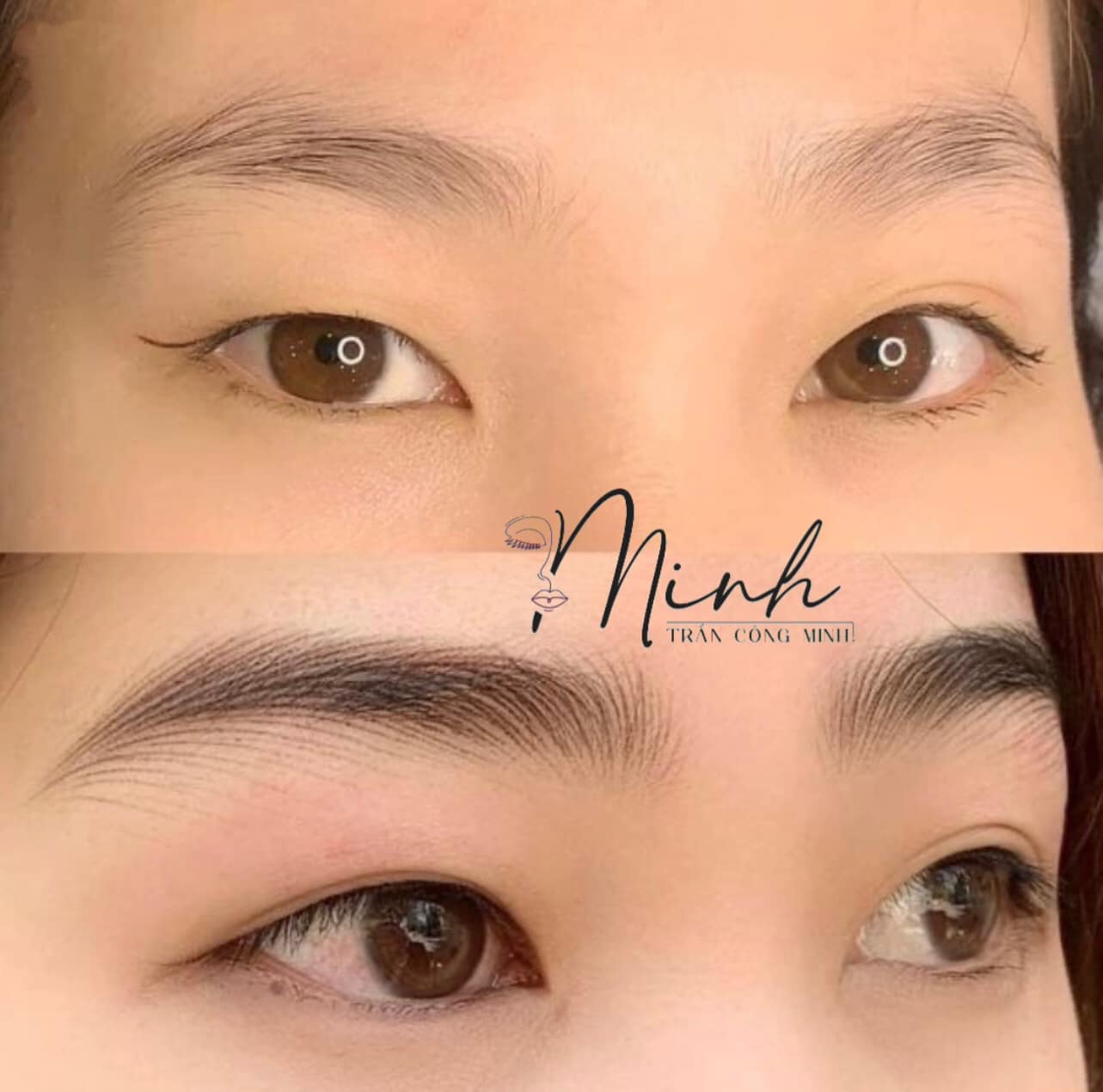 Top 3 Thẩm Mỹ Viện Uy Tín và Chất Lượng Nhất Năm 2024 ở Quận Phú Nhuận