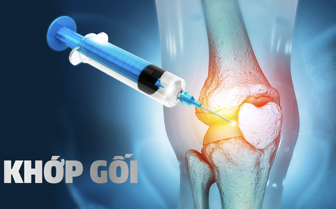 Khi nào cần tiêm chất nhờn vào khớp?