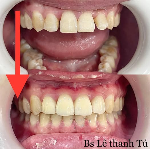 Đừng Bỏ Lỡ: 3 Địa Chỉ Nha Khoa Tốt Nhất Quận Tân Phú Được Người Dân Tin Chọn