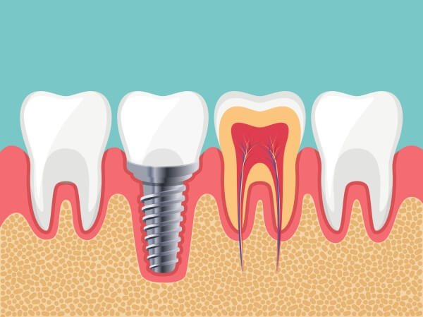 Top 3 Nha Khoa Uy Tín Nhất Quận 11 – Dịch Vụ Chuyên Nghiệp, Thiết Bị Hiện Đại