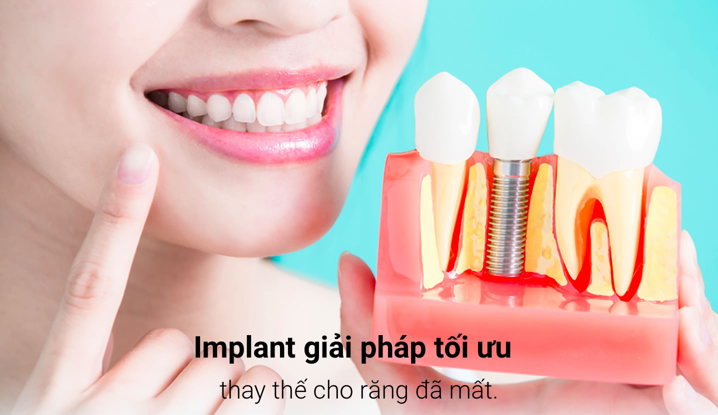 Top 3 Nha Khoa Cao Cấp, Uy Tín, Chất Lượng, Giá Cả Hợp Lý Ở Quận Bình Thạnh