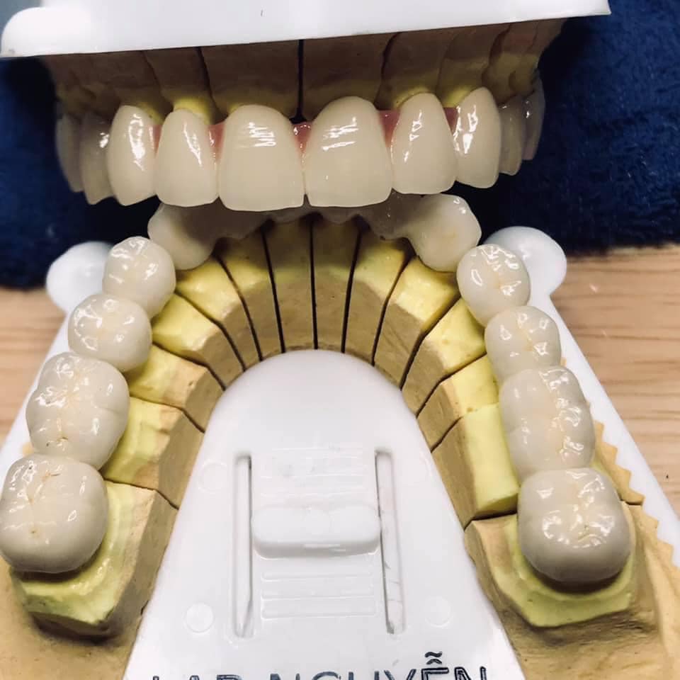 Top  3 Công Ty Sản Xuất Răng Sứ Thẩm Mỹ Ở Hồ Chí Minh