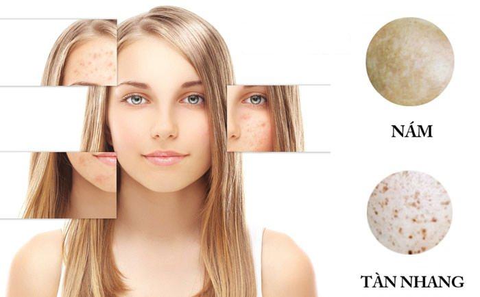 SPA ĐIỀU TRỊ NÁM TÀN NHANG 01