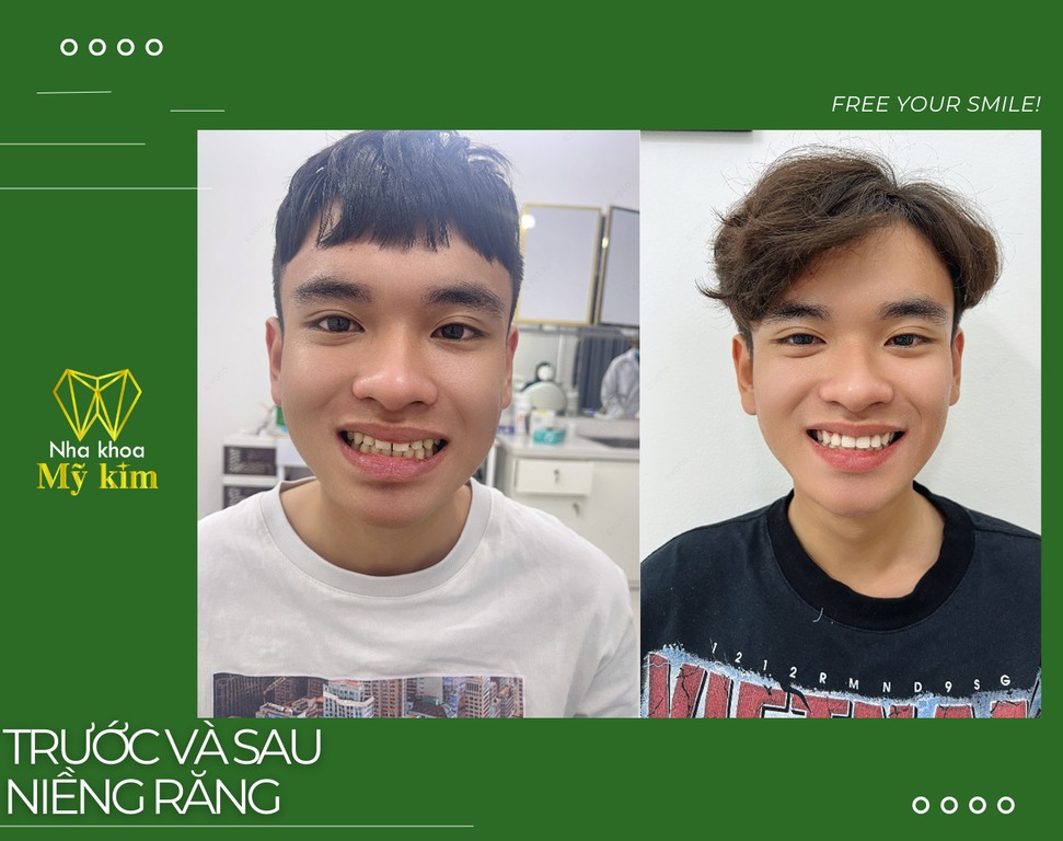 Top 3 phòng khám nha khoa uy tín tại quận Bình Tân TPHCM