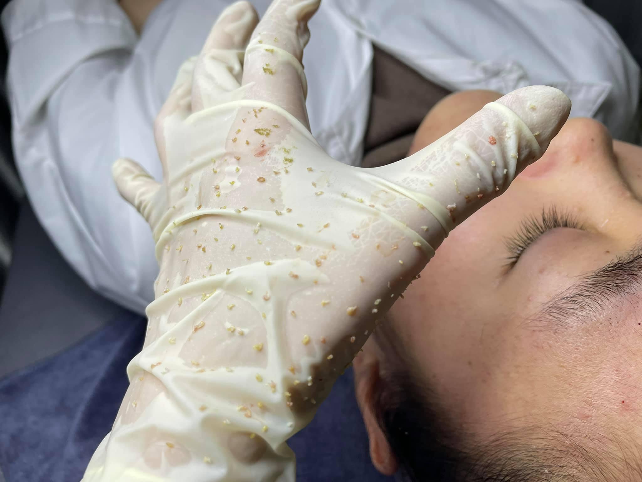 Top 3 Địa chỉ Spa trị mụn tốt nhất tại Thành phố Thủ Đức, HCM