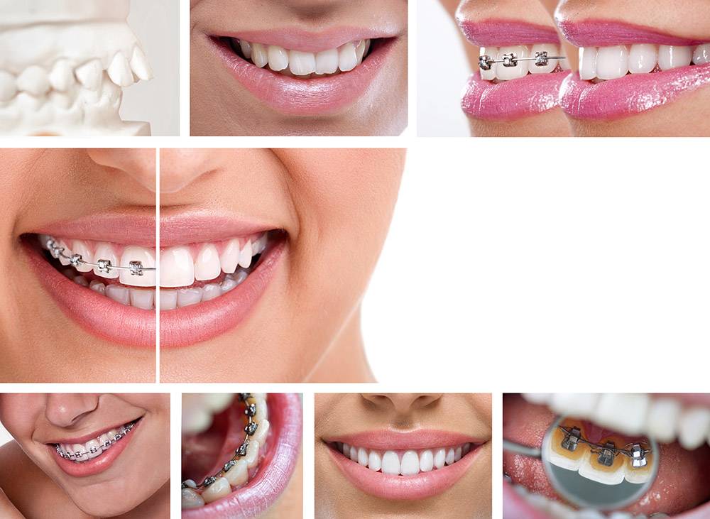 Top 3 nha khoa tại TP.HCM: Địa chỉ chăm sóc răng miệng đáng tham khảo