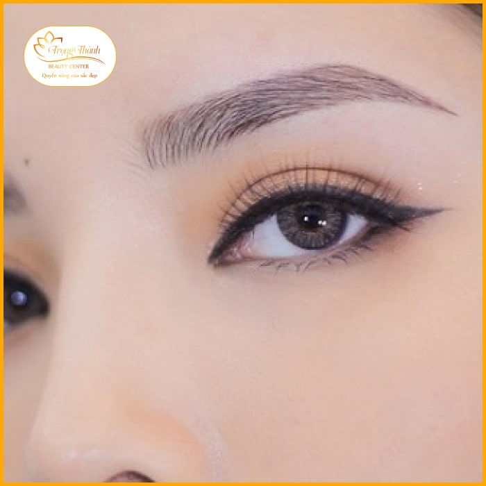 Top 3 Lý do chọn THẨM MỸ TRỌNG THÀNH