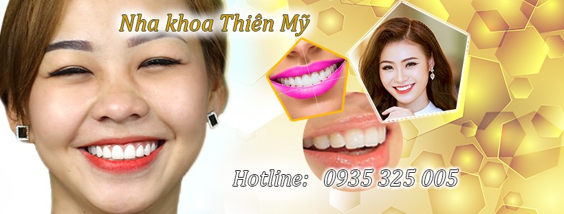TOP 3 DỊCH VỤ KHÁM RĂNG 5 SAO BẬC NHẤT TẠI TÂN BÌNH, HỒ CHÍ MINH