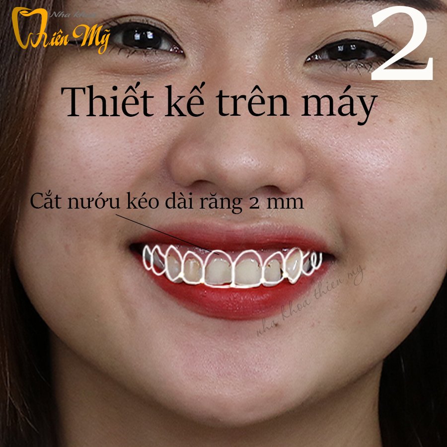 TOP 3 NHA KHOA UY TÍN VÀ CHẤT LƯỢNG NHẤT TẠI GÒ VẤP, HỒ CHÍ MINH