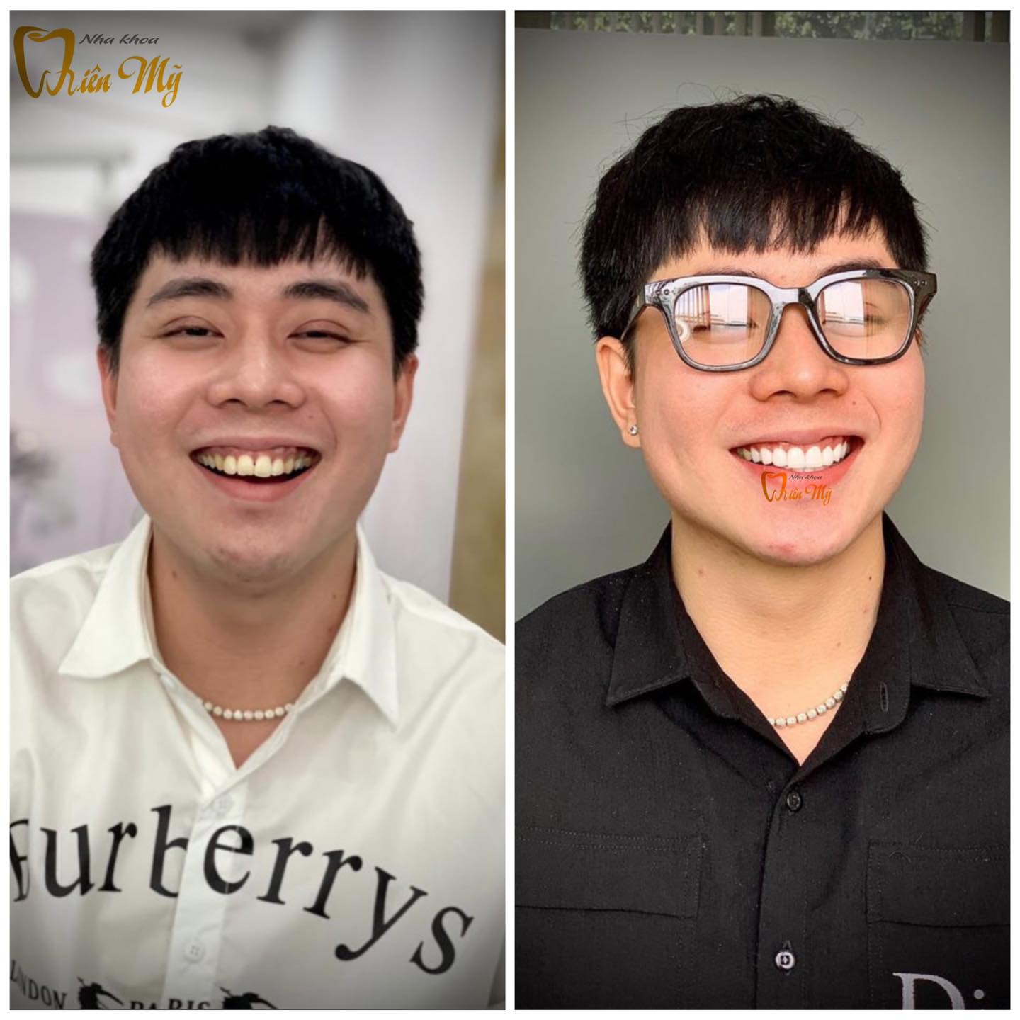 TOP 3 NHA KHOA UY TÍN VÀ CHẤT LƯỢNG NHẤT TẠI GÒ VẤP, HỒ CHÍ MINH