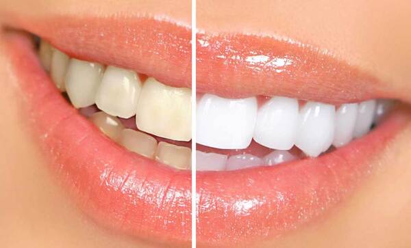 TOP 3 NHA KHOA UY TÍN VÀ CHẤT LƯỢNG NHẤT TẠI GÒ VẤP, HỒ CHÍ MINH