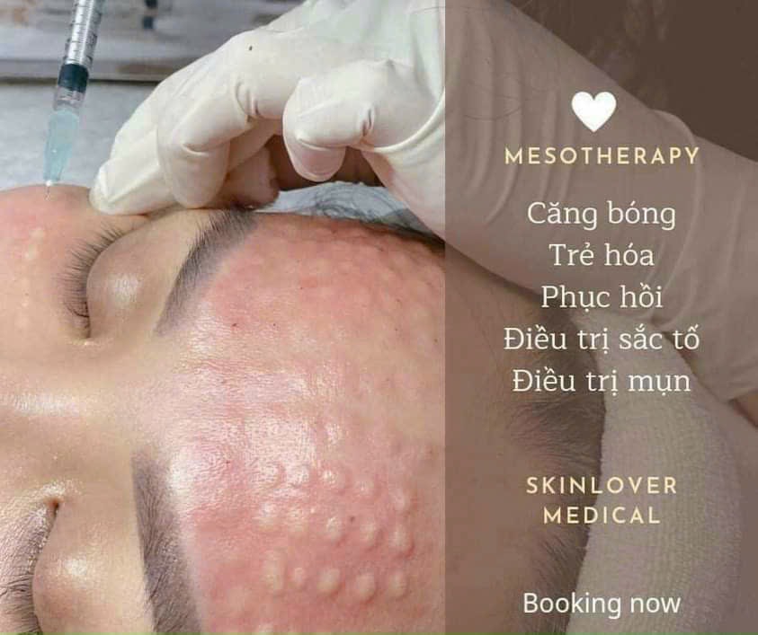 Spa Khả Tú - Cơ Sở Điều Trị Da Mụn Uy Tín Giá Tốt Tại Khu Vực Thủ Đức
