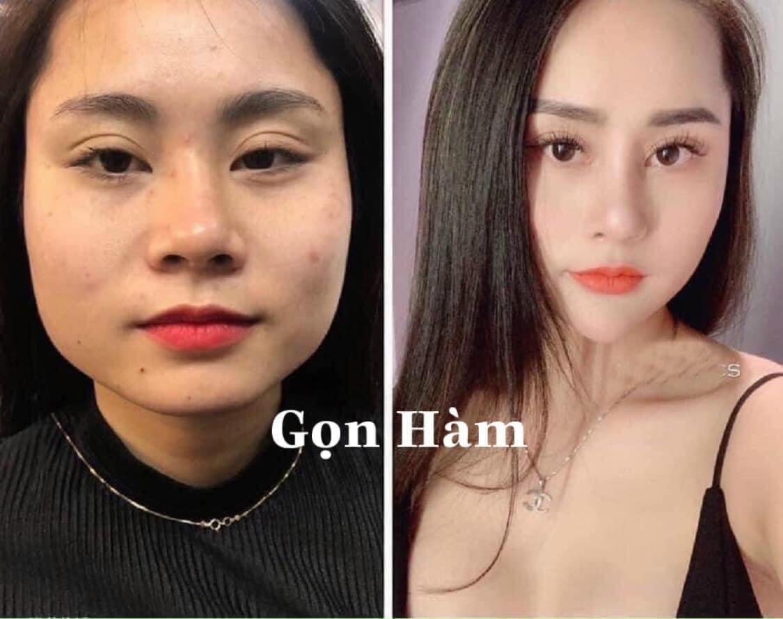 Chíp Beauty&Spa – Hệ thống làm đẹp đa dịch vụ tại TP. HCM, Hà Nội và Quảng Ninh