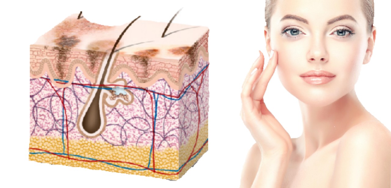 điều trị nám 02